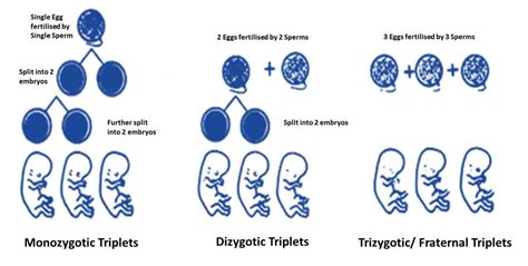 Identical Triplets, Myth or Reality! Can Triplets Be Identical??? - ParentingNMore