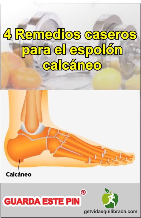 #Remedios_caseros para el #espolón_calcáneo#dolor_pies#dolor#talón# ...