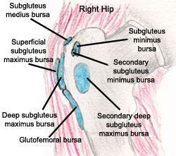 Trochanteric Bursitis – Causes, Symptoms, Exercises, Treatment, Surgery