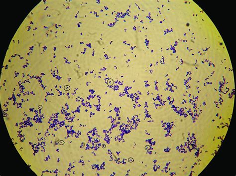 Morphological visualisation of Corynebacterium sp. after Gram stain... | Download Scientific Diagram