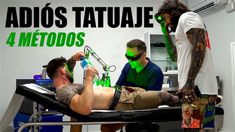 4 maneras de borrar tus tatuajes | Rene ZZ