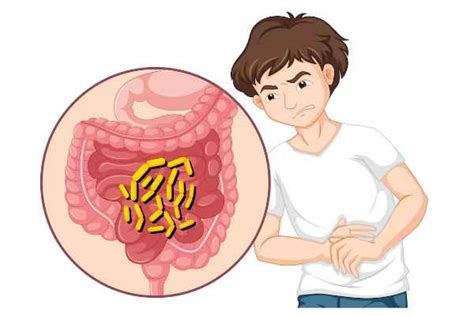 Gastrointestinal Stromal Tumor: Causes & Symptoms - TV Health