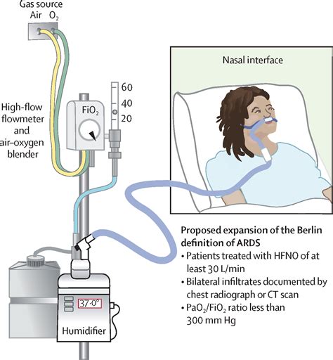 The Berlin definition of acute respiratory distress syndrome: should ...