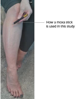 A study using moxibustion to reduce side effects of chemotherapy ...