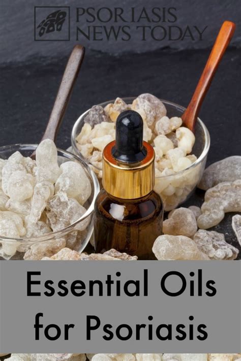 Essential Oils: Psoriasis – Psoriasis News Today