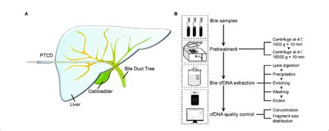 | Bile cfDNA extraction procedure and cfDNA quality control of 3D-BCF ...