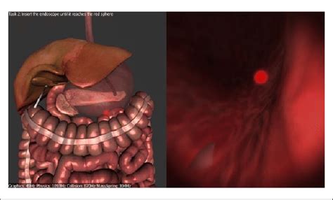 Navigating Inside The Stomach - Stomach (684x414), Png Download