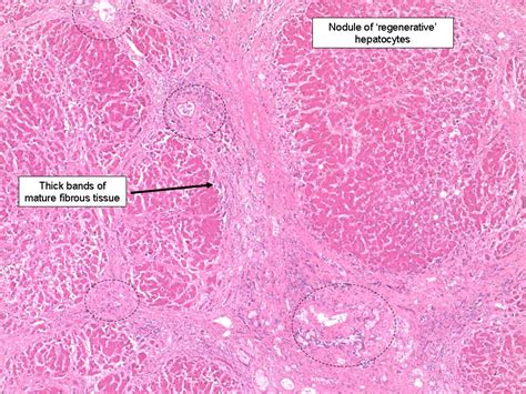 The liver ~ Medical student education – TissuPath