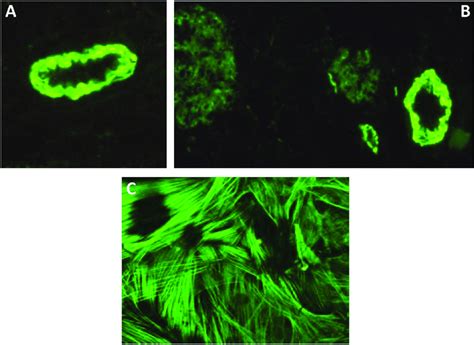 Anti-smooth-muscle antibodies. Immunofluorescence pattern of smooth... | Download Scientific Diagram