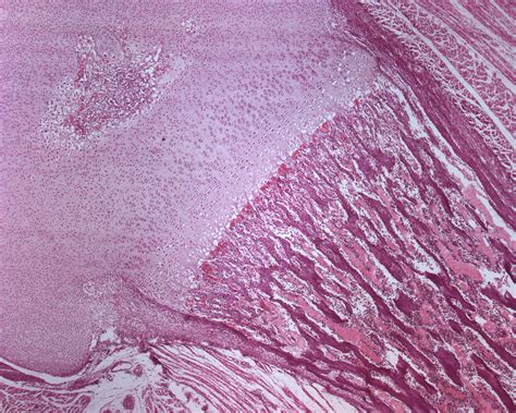 Epiphysis and diaphysis (40 X) - Anatomicum.com
