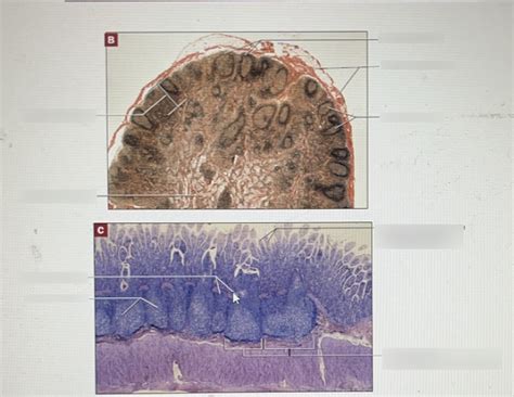 Lymph Node and Peyer's Patches in Ileum Histology Diagram | Quizlet