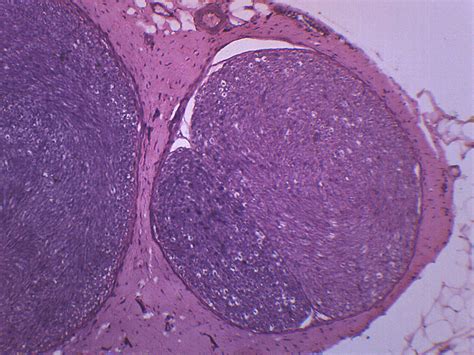 Peripheral Nerve, Mammal - Prepared Microscope Slide — hBARSCI