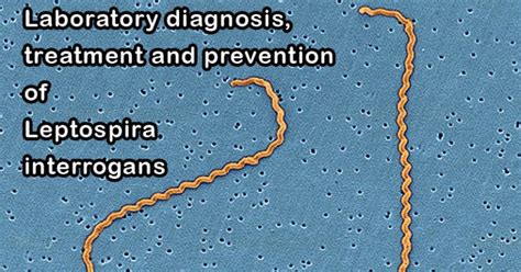 Laboratory diagnosis, treatment and prevention of Leptospira interrogans