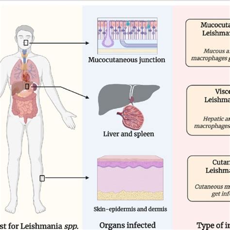 Types of leishmaniasis and the organs affected; Mucocutaneous... | Download Scientific Diagram