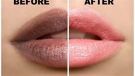 How Get Healthy Looking Lips Naturally - YouTube