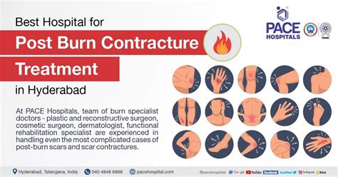 Best Hospital for Post Burn Contracture Treatment in Hyderabad