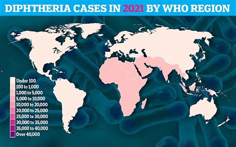 What IS diphtheria and how does the bug spread? | Daily Mail Online