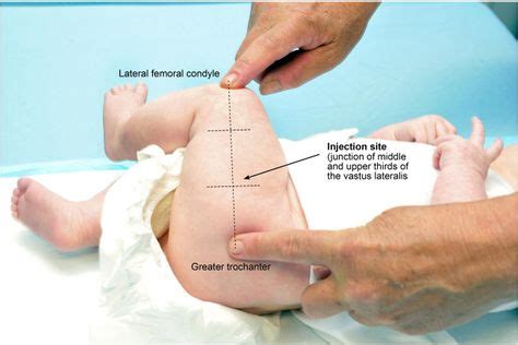 Figure 2.1: Photo showing the infant lateral thigh injection site | Enfermería | Newborn nursing ...