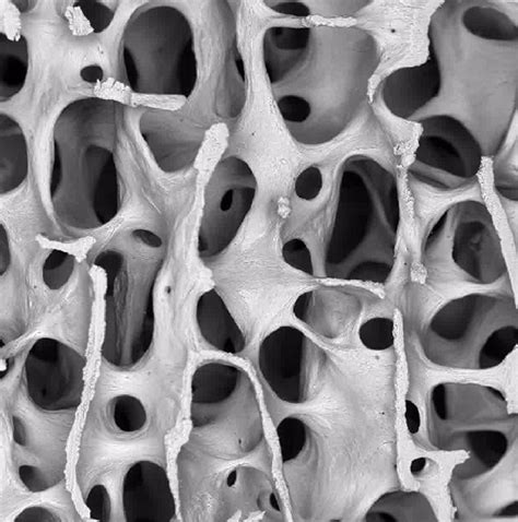 Normal Bone - Bone Research Society