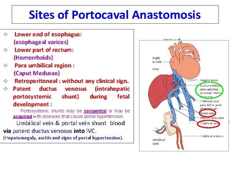 Major Blood VesselsVeins By Associate Prof Khaleel Alyahya