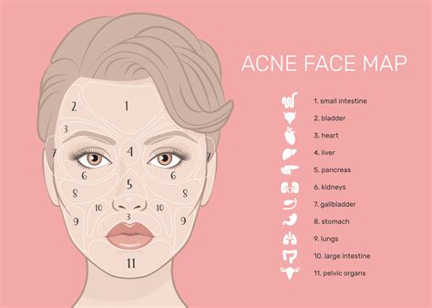 How to Manage Acne Prone Skin