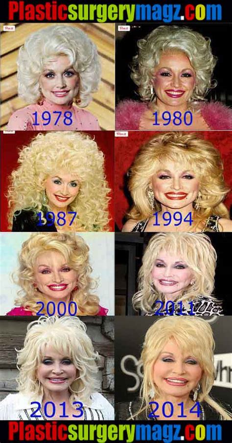 Dolly Parton Without Makeup And Wig - Mugeek Vidalondon