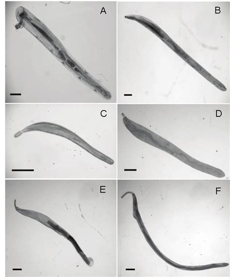 Morphology of three adult acanthocephalans illustrated by light... | Download Scientific Diagram