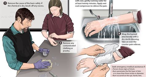 First Aid: How to Treat a Chemical Burn – Art as Applied to Medicine