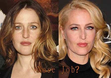 GILLIAN ANDERSON NOSE JOB PLASTIC SURGERY BEFORE AND AFTER | Nose Job | Gillian,erson plastic ...