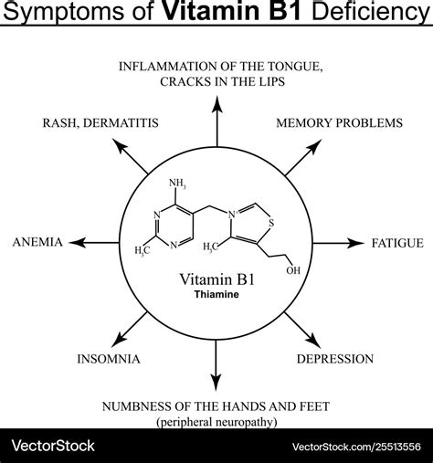 Thiamine Deficiency Symptoms, Causes And Recommended Intake, 52% OFF