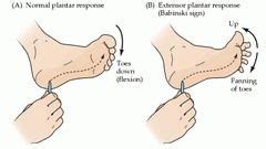 Pics For > Plantar Reflex | Plantar reflex, Primitive reflexes, Fundamentals of nursing