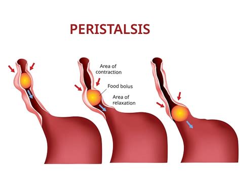 Peristaltik, Fungsinya pada Sistem Pencernaan dan Gangguan yang Dapat Terjadi - Alodokter