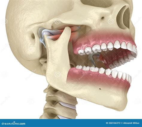 TMJ: the Temporomandibular Joints. Healthy Occlusion Anatomy Stock ...