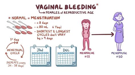 Abnormal uterine bleeding: Clinical: Video & Anatomy | Osmosis