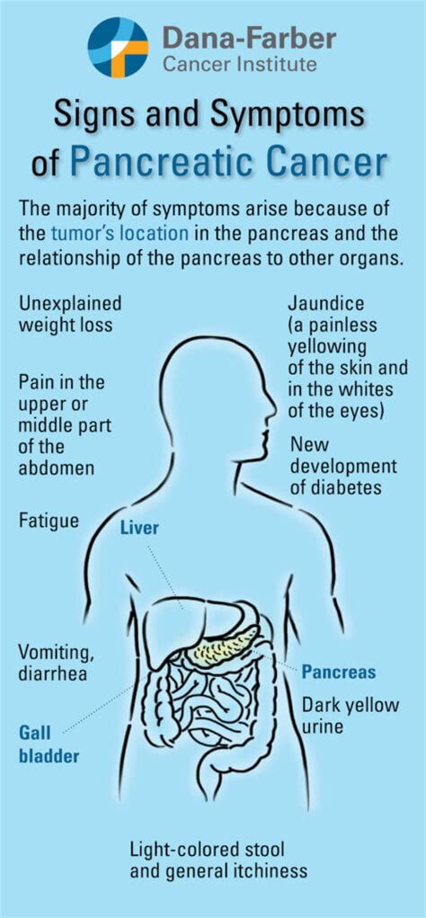 Pancreatic Cancer Symptoms | Dana-Farber Cancer Institute