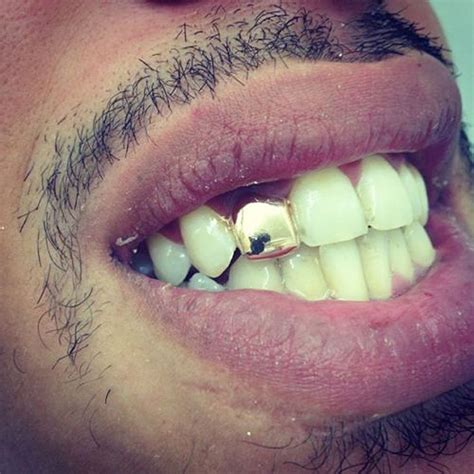 Small Single Tooth Cap | Gold teeth grills, Gold teeth, Teeth caps