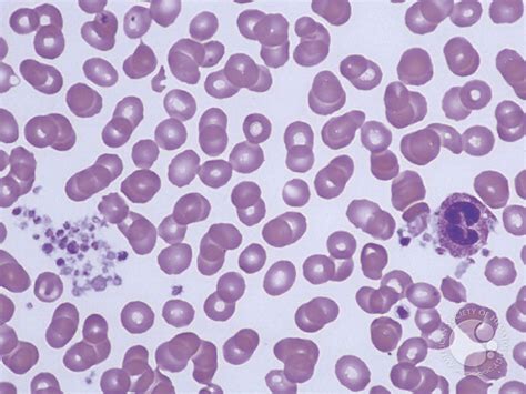 Leukocyte Phagocytosis of Platelets - 1.