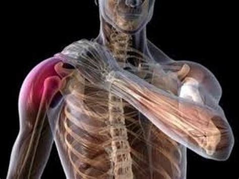 An Effective Self Treatment for Shoulder(Tendonitis) :How To Sleep Better with Shoulder Pain ...