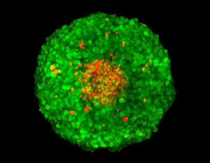 Confocal Microscopy | Principle & Applications | ibidi