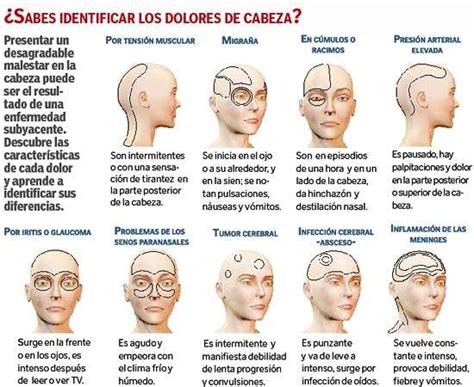 Dolor de cabeza - Causas y remedios