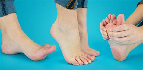 Foot Exercises: 10 Moves That Have A Big Impact On Health ...