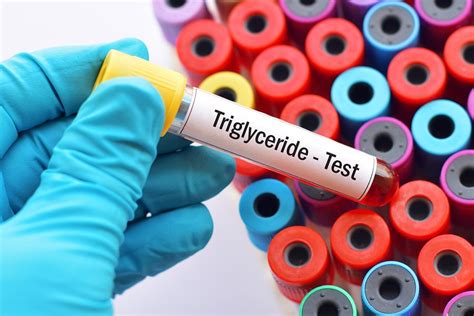 13 Causes of High Triglycerides + Normal Levels - SelfDecode Labs