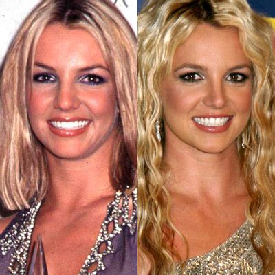 Britney Spears Plastic Surgery Before and After Liposuction and Rhinoplasty | Famous Plastic ...