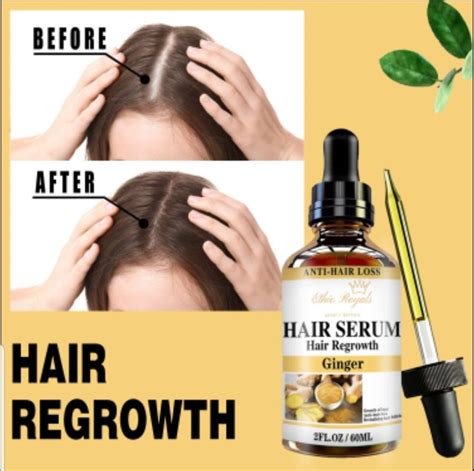 Hair Serum-hair Regrowth Growth Serum Infused With - Etsy