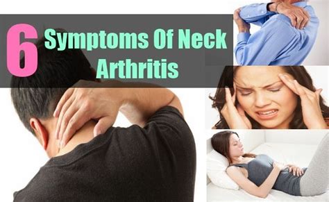 6 Symptoms Of Neck Arthritis | Neck arthritis, Rheumatoid arthritis treatment, Cervical spondylosis