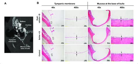 | Histology of the tympanic membrane (TM) and mucosa at the base of the... | Download Scientific ...