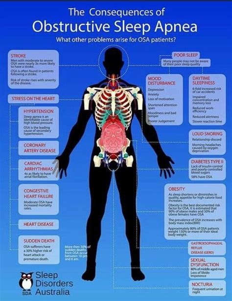 Sleep Apnea Signs and Symptoms