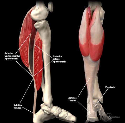 Achilles Tendon Pathology - Radsource