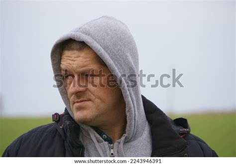 Acromegaly Face Medicine Man Skin Stock Photo 2243946391 | Shutterstock