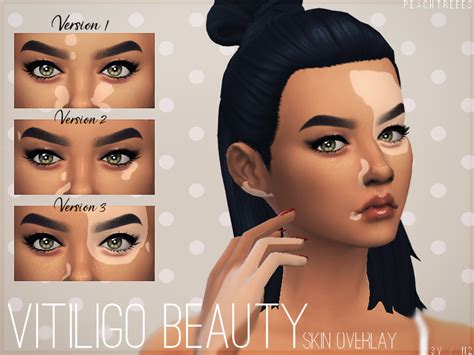 The Sims Resource - Vitiligo Beauty Skin Overlay N2